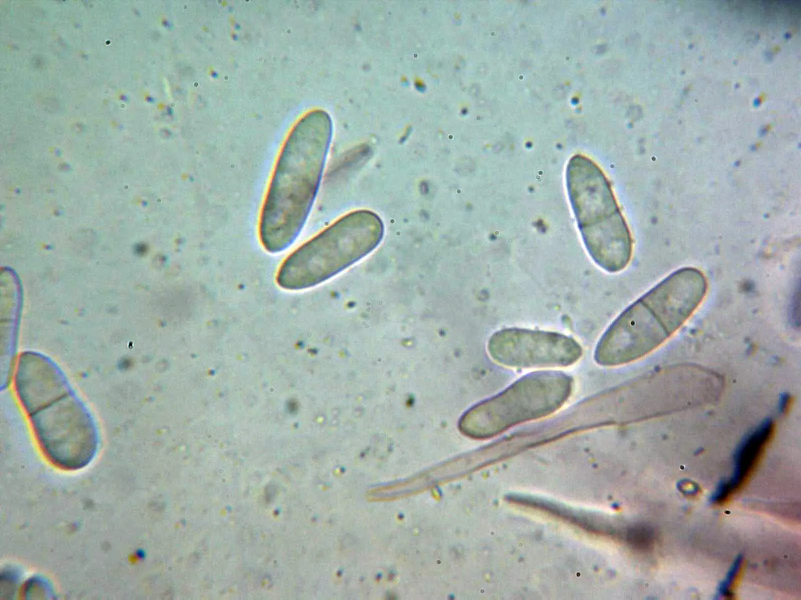 Microscopía de Mycogone rosea - 10 - Conidios 3